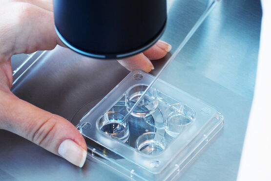 Kinderwunsch Untersuchung beim Mann